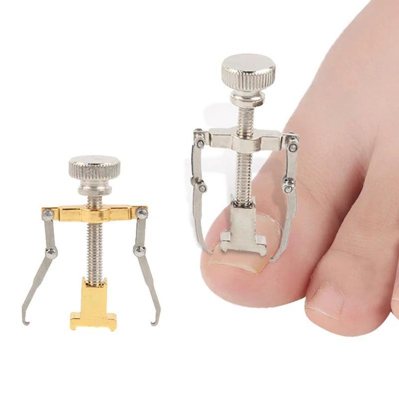 Toe Nail Correction Bracket – Paronychia Treatment & Toe Fixator for Toe Care - ClubOn