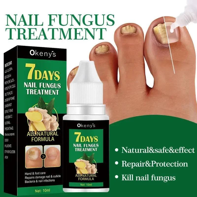 Extra Strong Nail Fungus Treatment Serum – Anti-Infection Toe Fungal Removal & Nail Repair Essence - ClubOn