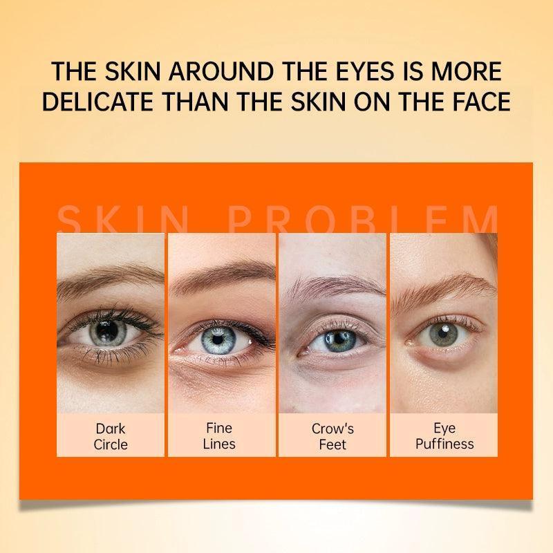 Vitamin C Eye Cream – Anti-Dark Circles, Eye Bags & Wrinkles - ClubOn