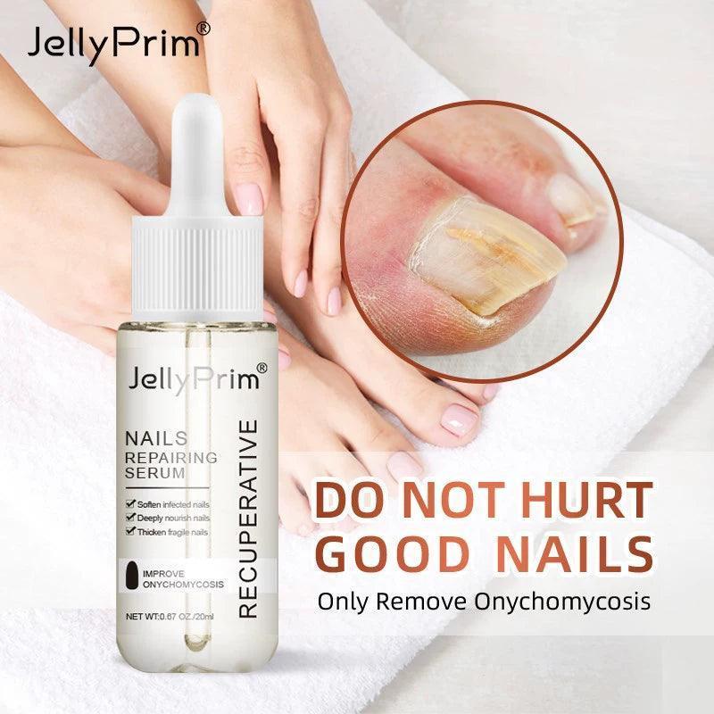 Nail Fungus Treatment Gel - Restores Healthy Nails & Care - ClubOn