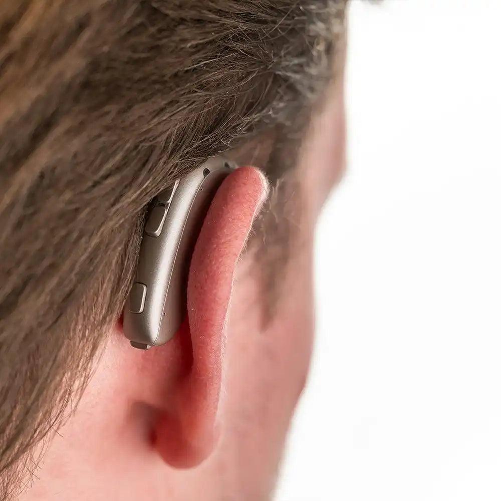 Oticon Xceed Hearing Aids for Severe-to-Profound Hearing Loss - ClubOn