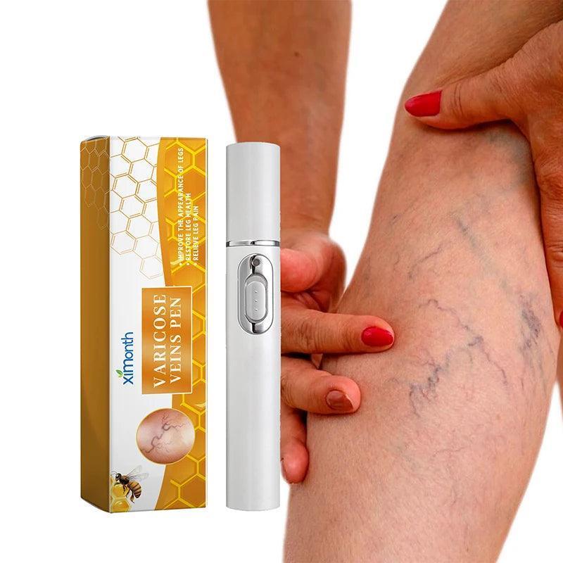Therapy Leg Repair Pen for Blood Circulation & Varicose Veins - ClubOn